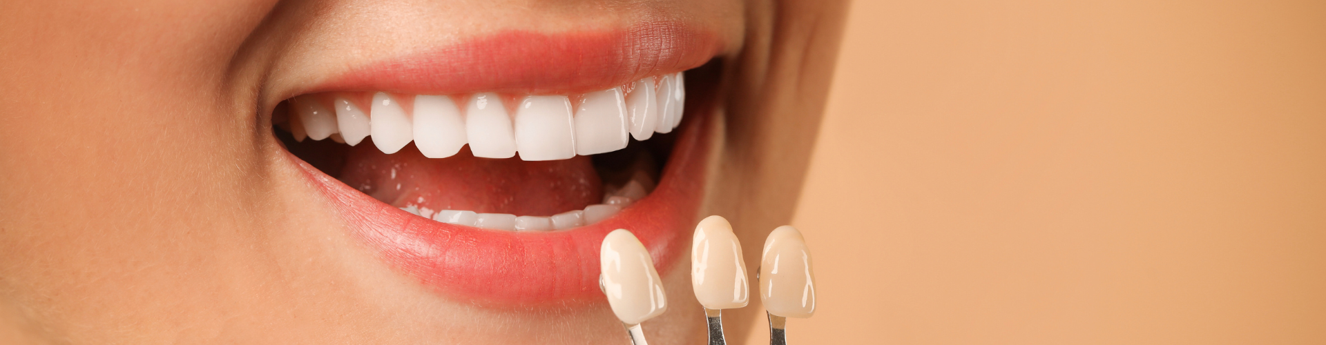 Gloved hand holding tooth shade-matching tool against woman's smile.
